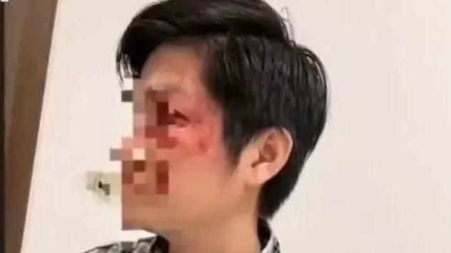 爸爸为了保护儿子,踢了没拴狗绳的狗,狗主人一拳KO爸爸