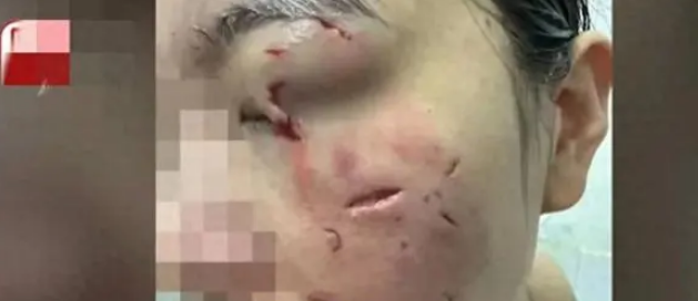 一向乖巧的宠物狗，被一女子逗发性情，后果不堪