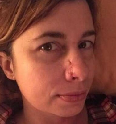 狗狗一直扑女子身上嗅她的鼻子，反常行为救下主人生命